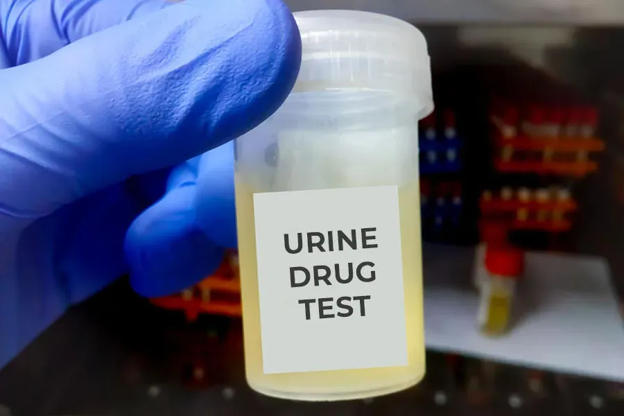 Gloved hand holding a urine sample cup for drug testing